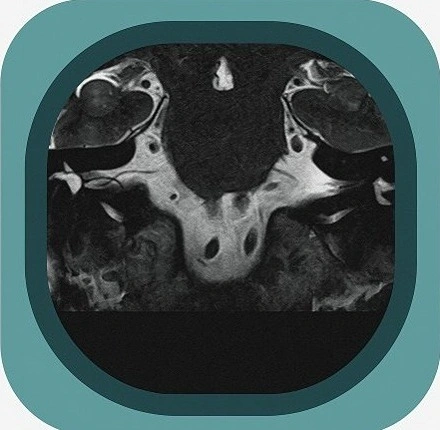 MRI cranial nerves anatomy icon
